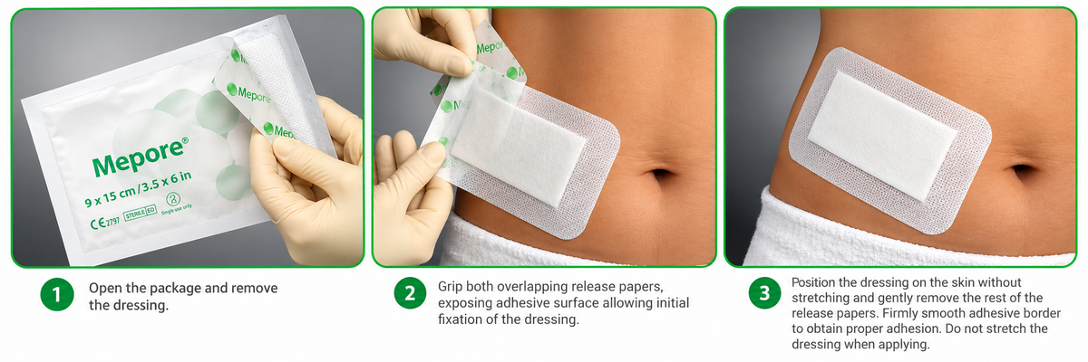 Mölnlycke Mepore Surgical Dressing