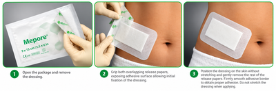 Mölnlycke Mepore Surgical Dressing