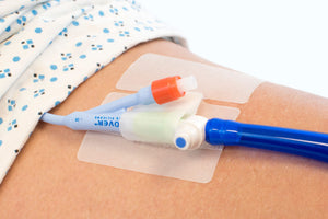 Image of Secure Lock Catheter