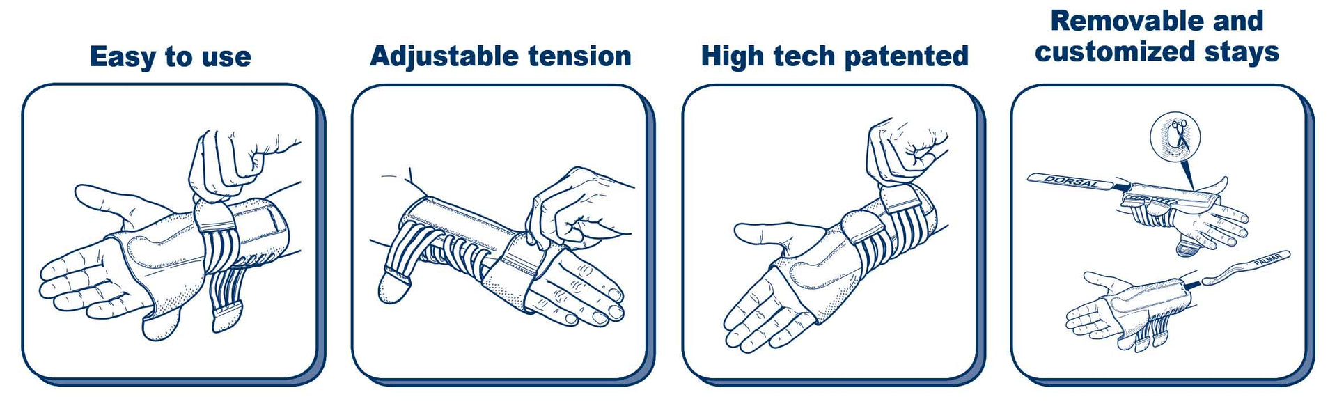 M-Brace Wrist Splint